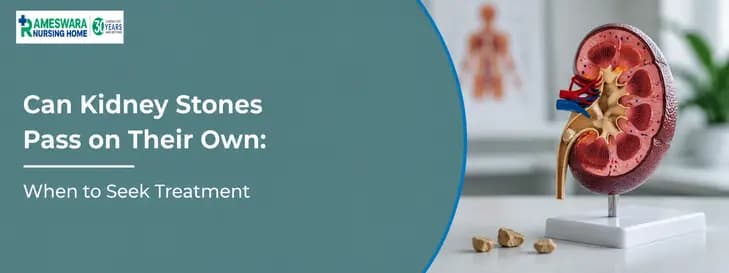 Can Kidney Stones Pass on Their Own 1